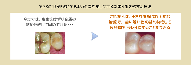 歯科の最先端の治療方法